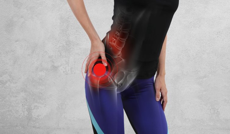woman with hip joint pain. sport exercising injury